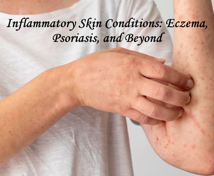 Inflammatory Skin Conditions